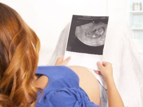 孕妇分阶段食谱-孕妇各个时期阶段营养食谱推荐